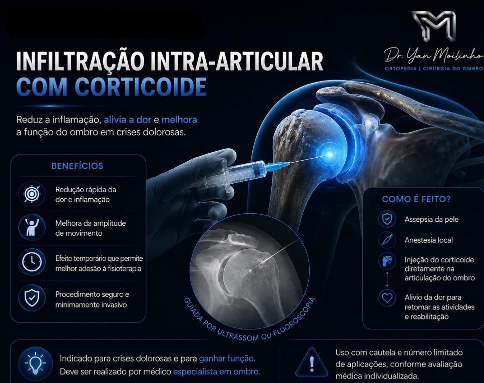Infiltração Intra-articular com Corticoide