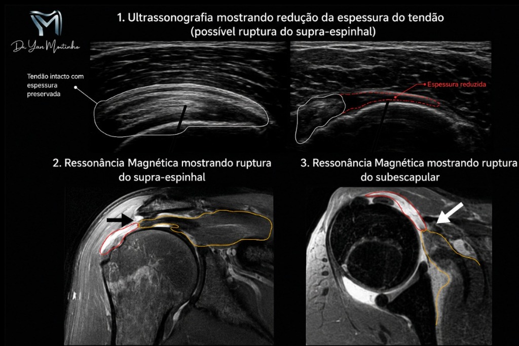 Exames de Diagnóstico por Imagem