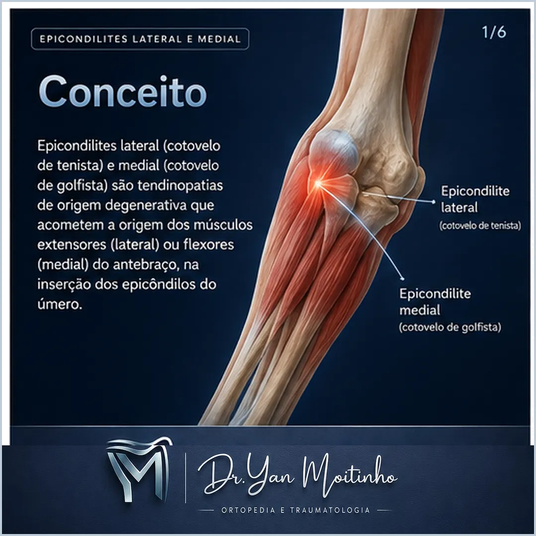 Conceito e Anatomia