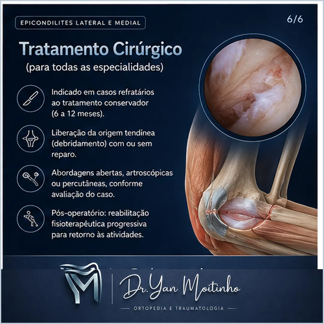 Tratamento Cirúrgico