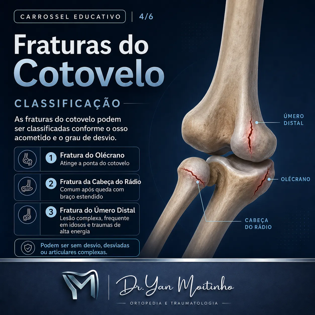 Classificação Clínica de Kellgren-Lawrence