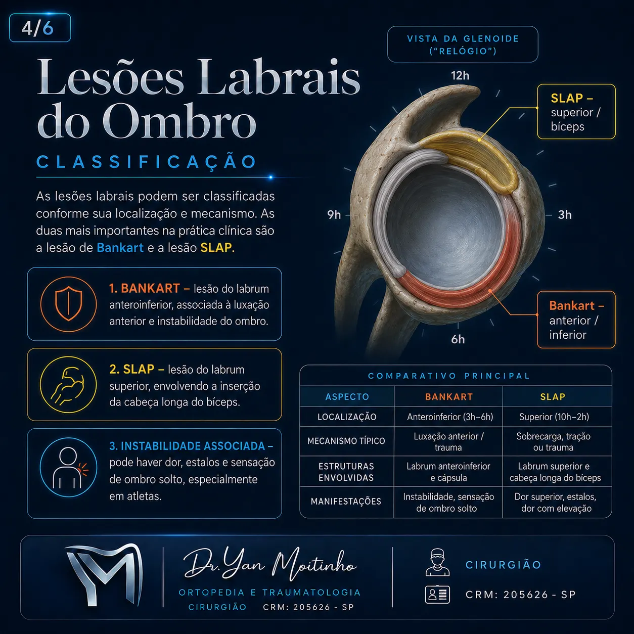 Classificação Clínica de Kellgren-Lawrence
