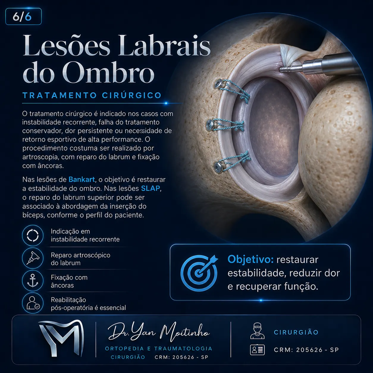 Tratamento Cirúrgico