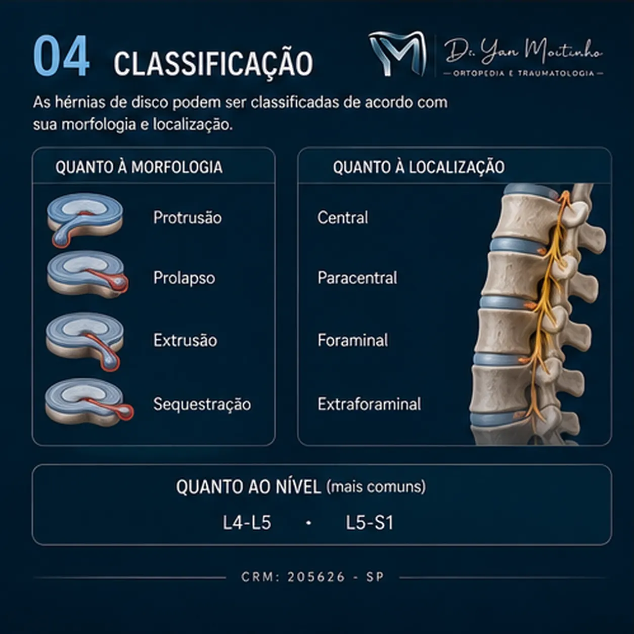 Classificação Clínica de Kellgren-Lawrence