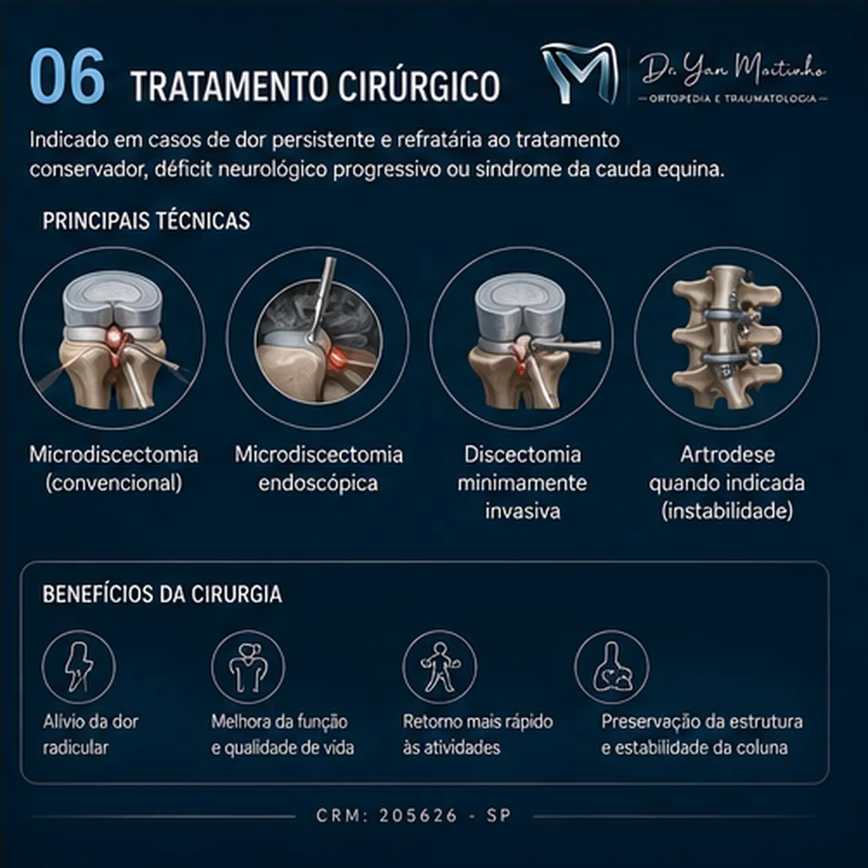Tratamento Cirúrgico