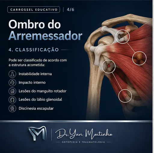 Classificação Clínica de Kellgren-Lawrence