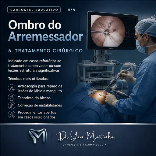 Tratamento Cirúrgico