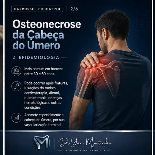 Epidemiologia e Fatores de Risco