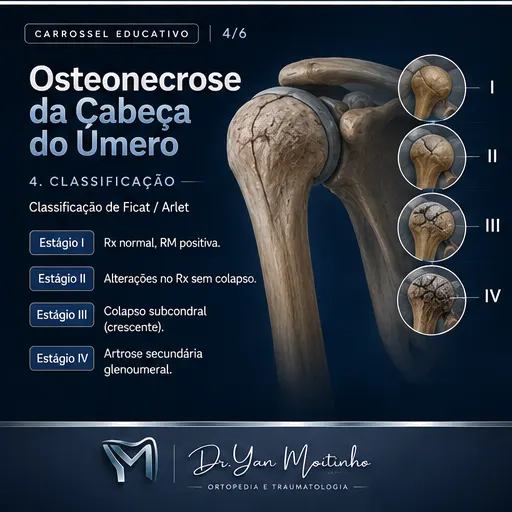 Classificação Clínica de Kellgren-Lawrence