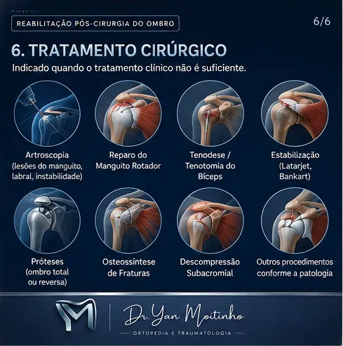 Tratamento Cirúrgico