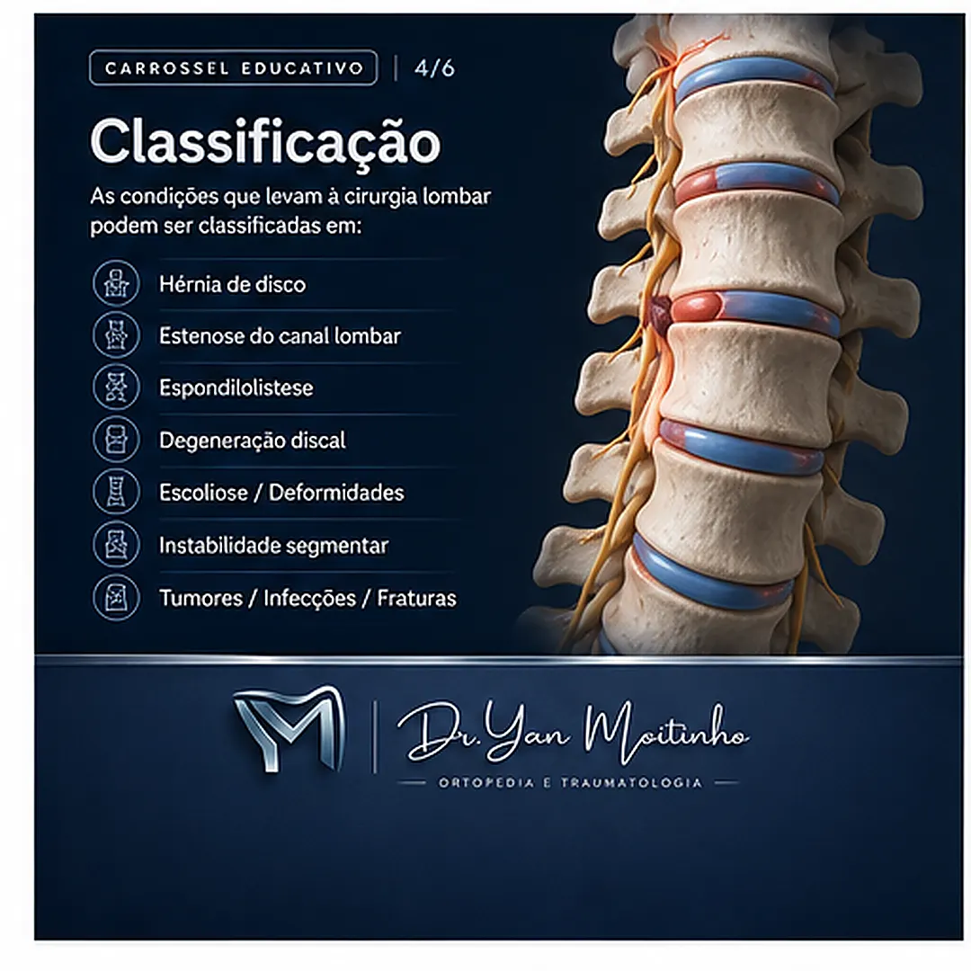 Classificação Clínica de Kellgren-Lawrence