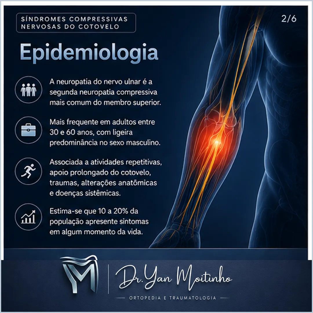 Epidemiologia e Fatores de Risco