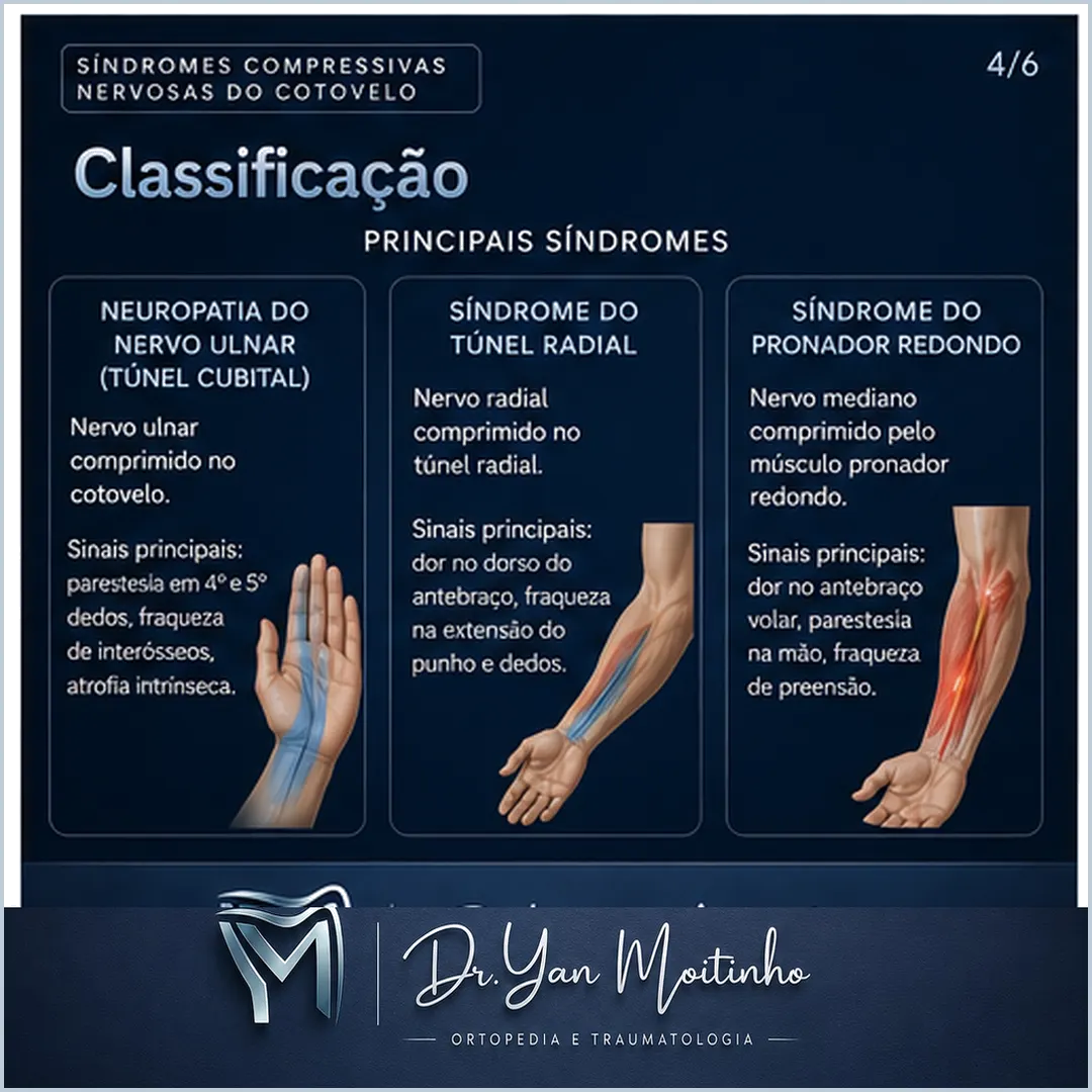 Classificação Clínica de Kellgren-Lawrence