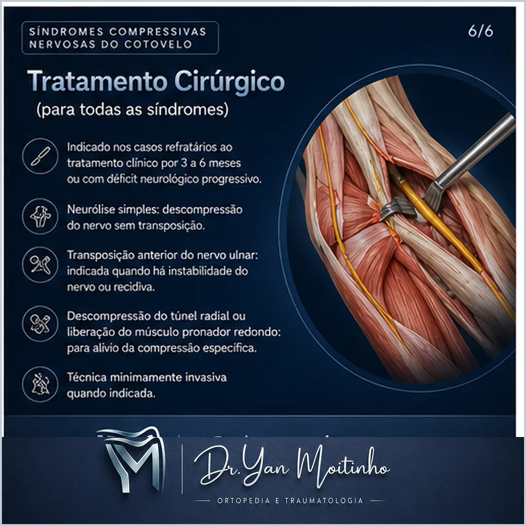 Tratamento Cirúrgico